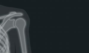 shoulder specialist